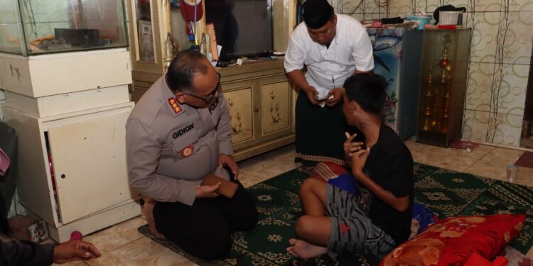 Kapolres Metro Jakut Jenguk Anak Korban Penyiraman Air Keras