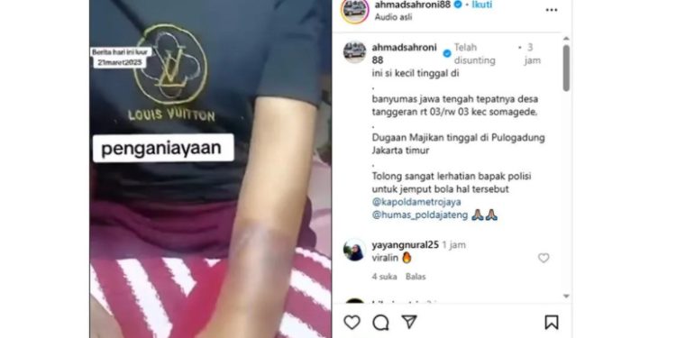 Polisi Selidiki Kasus Penganiayaan IRT