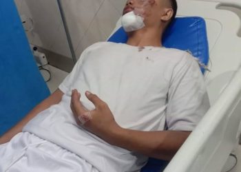 Hendak Tes Kesehatan, Casis Bintara Polri Dibegal