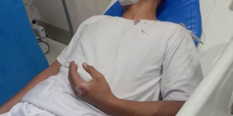 Hendak Tes Kesehatan, Casis Bintara Polri Dibegal