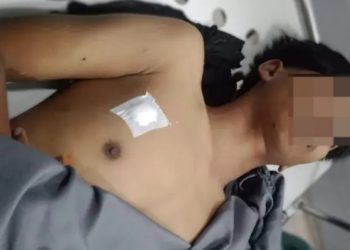 Bentrok Antar Warga Pecah, Seorang Remaja Tewas Tertembak Senapan Angin