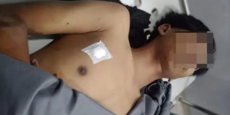 Bentrok Antar Warga Pecah, Seorang Remaja Tewas Tertembak Senapan Angin