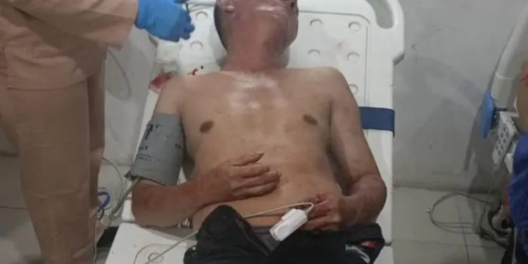 Suami Pembunuh Istri di Medan Area Masih Kritis