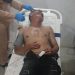 Suami Pembunuh Istri di Medan Area Masih Kritis