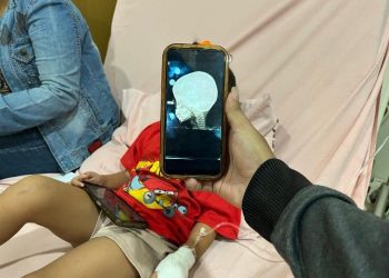 Bocah 4 tahun Terkena Peluru Nyasar di Medan