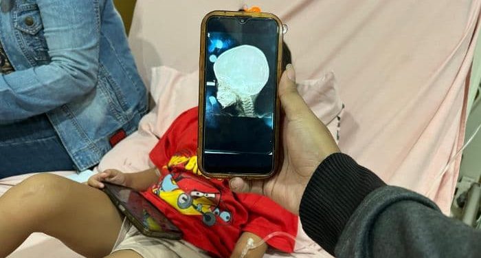 Bocah 4 tahun Terkena Peluru Nyasar di Medan