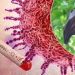 Tingkat Fatalitas Capai 75 persen, Virus Nipah belum ada Obatnya